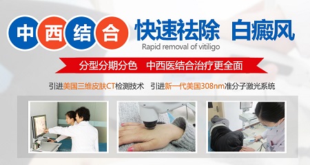 现在有治疗白癜风的新技术吗