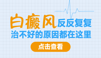 白癜风
