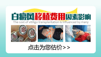 黑色素移植治白癜风大概费用多少