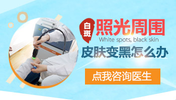 白斑照光后边缘有点发黑是什么情况