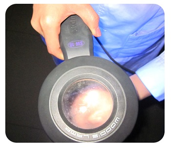 新出现的白癜风在伍德灯下的症状表现