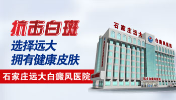 白癜风患者如何选购自行车