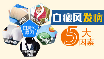 免疫力差就容易得白癜风吗