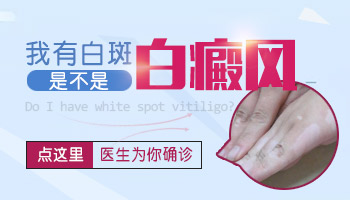 脸上一块一块白是不是白癜风