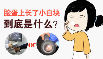 脸上有隐隐的白点怎么回事