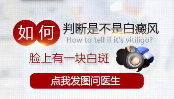 左侧脸上白一块是什么病