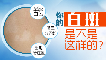 不是特别白的米粒大小白斑是白癜风吗