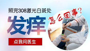 308激光照白斑为什么会发痒