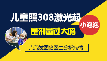 治疗儿童白癜风不吃药还有什么方法