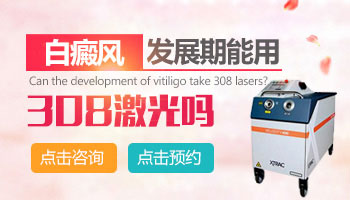 小孩白癜风处于发展期能照308激光吗