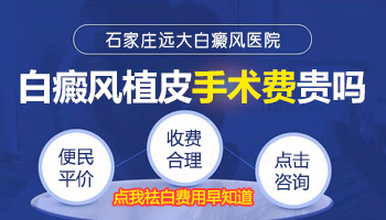 植皮治疗白癜风是按面积收费吗