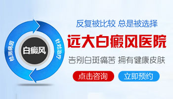 石家庄治白癜风哪里可以治好