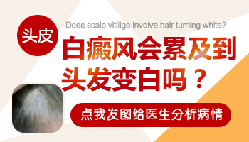 宝宝头皮上有白斑且头发变白怎么回事