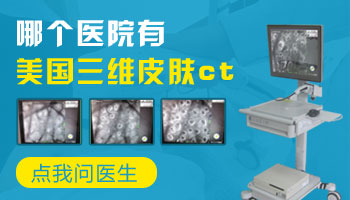确诊白斑是不是白癜风为什么做皮肤ct