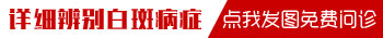 4岁宝宝脸上长淡白色白斑是为什么