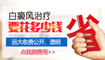 几千块钱可以治好早期的白癜风吗