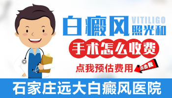激光治疗皮肤白斑贵不贵