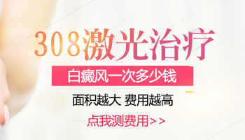 手指白癜风照308激光多少钱