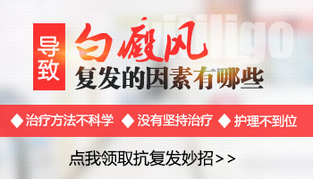 夏季白癜风复发都和什么因素有关