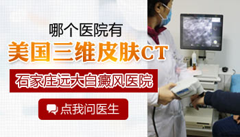 白斑照伍德灯有白色荧光就一定是白癜风吗