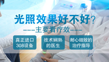 白癜风打激光后的效果