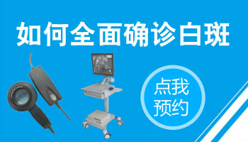 脸上有白斑怎么回事如何确诊是白癜风