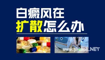 孩子白癜风扩散后吃什么药