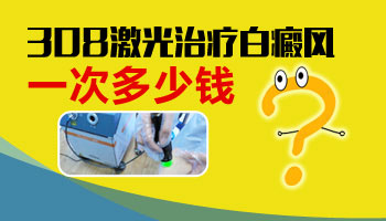 白癜风大约花多少钱能治好