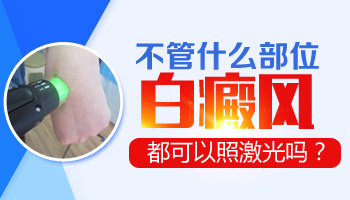 脸上脖子上都有白癜风可以照激光吗
