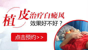 白癜风植皮有没有风险