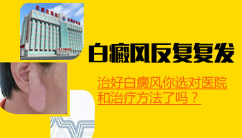 白癜风3年了还在扩散怎么治疗好