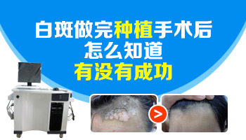 白癜风做黑色素种植可以一次成功吗