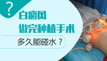 白斑做完移植可以碰水吗