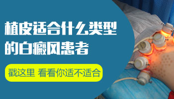头上有一小块白癜风能做皮肤移植吗