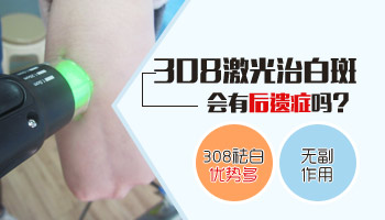 女性身上有白癜风还扩散了怎么治疗好