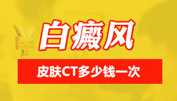 白斑做三维皮肤ct检查一次是多少钱