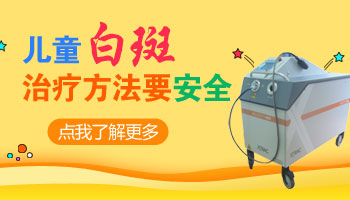 复发的儿童手指白癜风好治疗吗