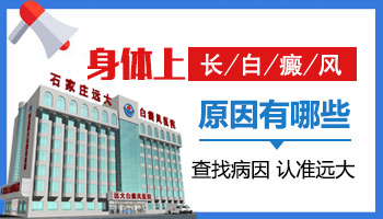 白斑怎么回事为什么脸上长白斑