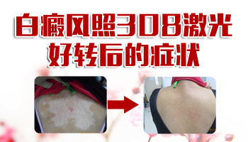 肉眼看不到的白斑用做纳晶定向吗