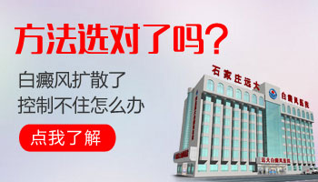 为什么白癜风一到夏天就扩散