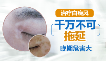 夏天到了白癜风越来越多用什么方法治疗好