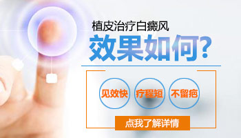 植皮治白癜风以后白斑部位特别黑怎么办
