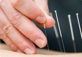 白癜风能一边用激光治疗一边扎火针吗