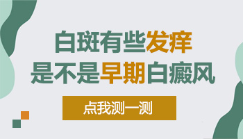 肚皮上长白斑怎么检查是不是白癜风