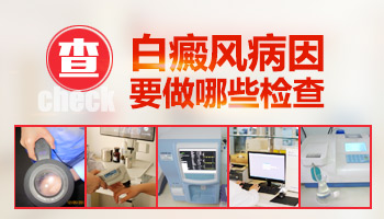 检查白癜风用什么仪器