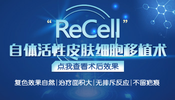 recell自体黑色素细胞再生术治白癜风案例