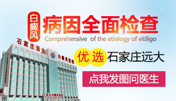 邢台哪家医院检查白癜风查的准