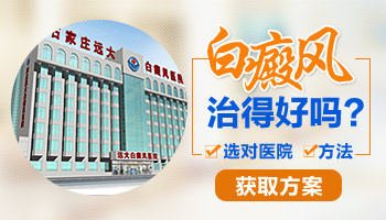 邯郸白癜风哪里治的好