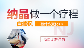 手上长了4块白癜风擦生姜有效果吗