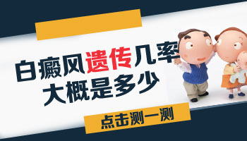 遗传性的白癜风可以治好吗